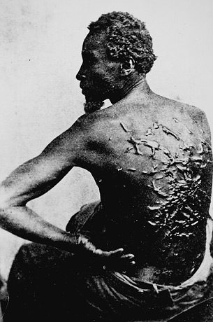 slavery-black-slaves-back-littered-with-scars-from-whipping[1]